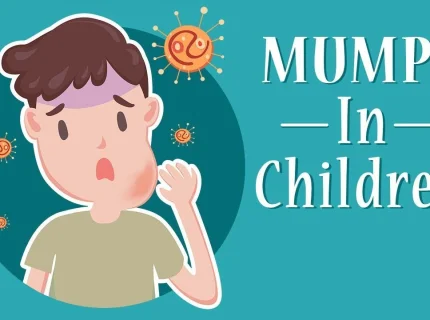 mumps