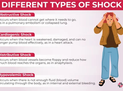 shock