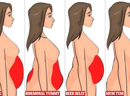 tummy