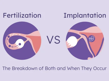 implantation
