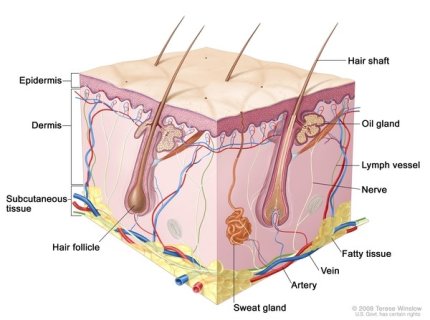 xeroderma