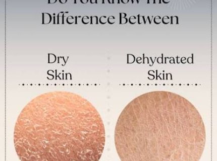dryish